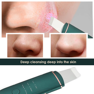 Ultrasonic Facial Skin Cleansing Scrubber